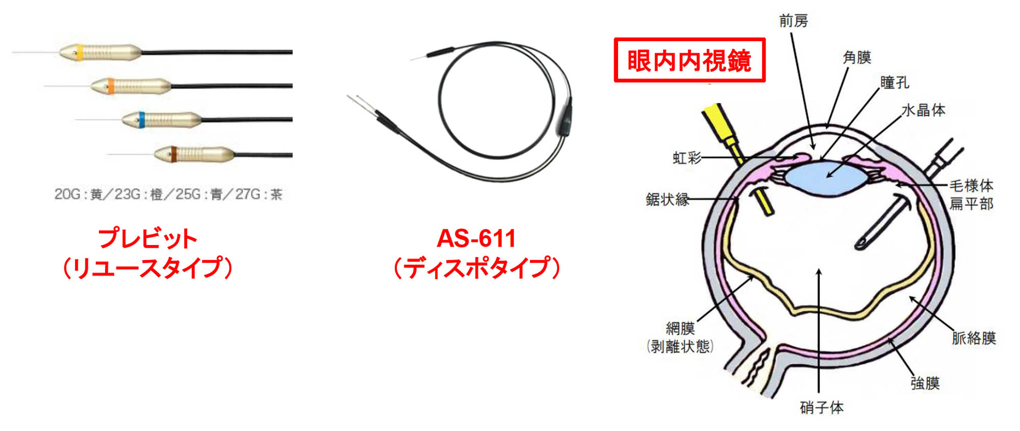 眼内内視鏡