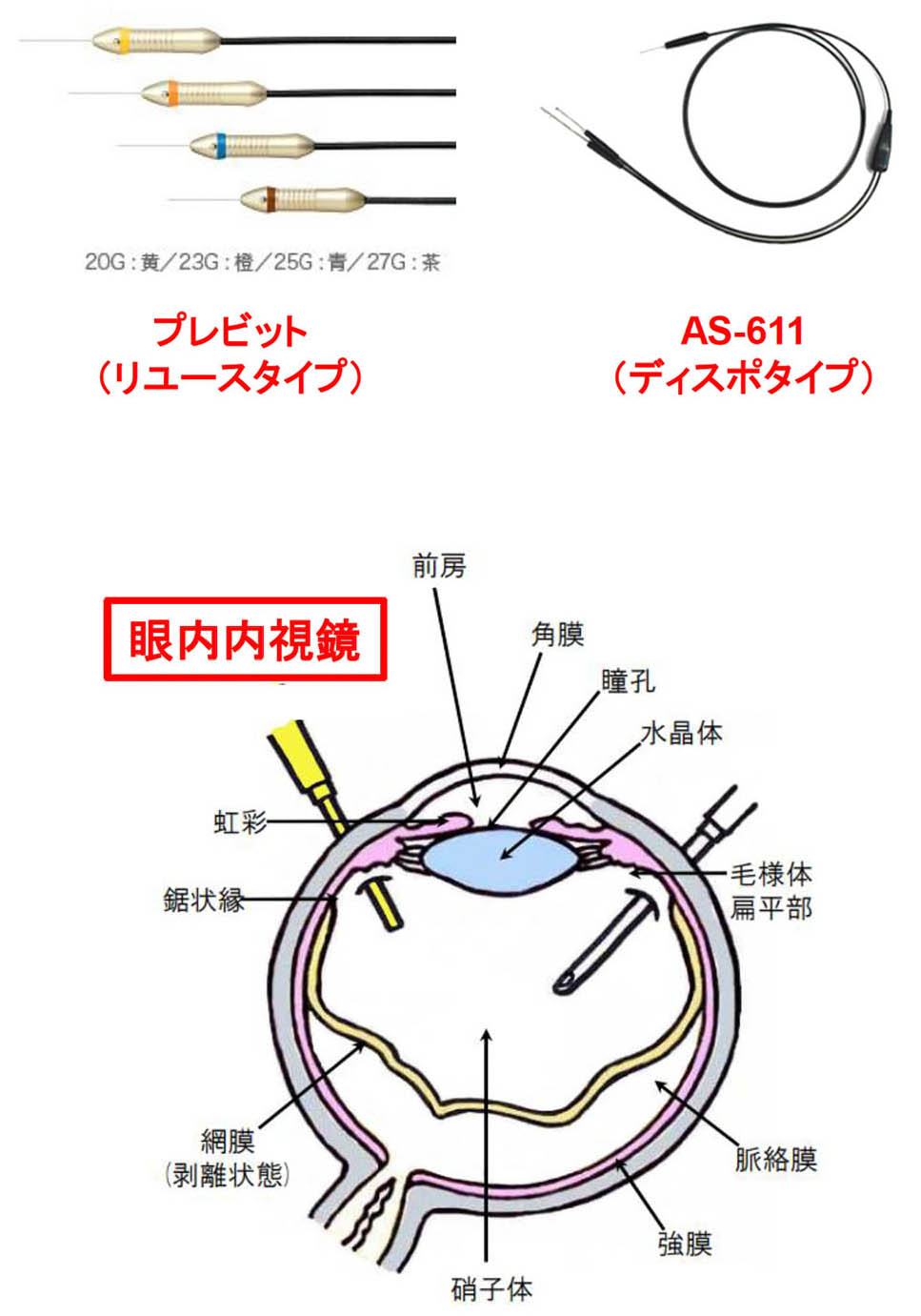 眼内内視鏡